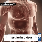 Detoxol Acua – Gotas Naturales para Desintoxicación y Equilibrio Intestinal