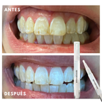 Smile White™ — El Lápiz Blanqueador 4X Más Potente (Promo 2x1)