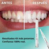 Smile White™ — El Lápiz Blanqueador 4X Más Potente (Promo 2x1)