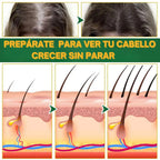 OUHOE Hair Elixir – Recupera tu Cabello Naturalmente
